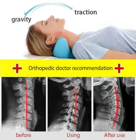 Ergonomic Neck Massage Pillow Cervical Traction Device - CAMMUO - Sleep Galleria