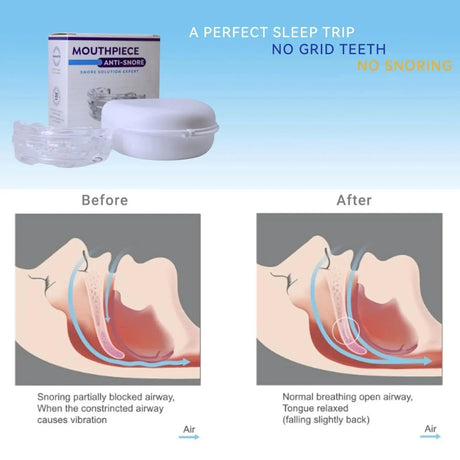 Adjustable Transparent Anti Snore Mouth Guard - MIPHESLY - Sleep Galleria