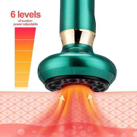 Intelligent Rechargeable Electric Cupping Massage Device - Ms.Dear - Sleep Galleria